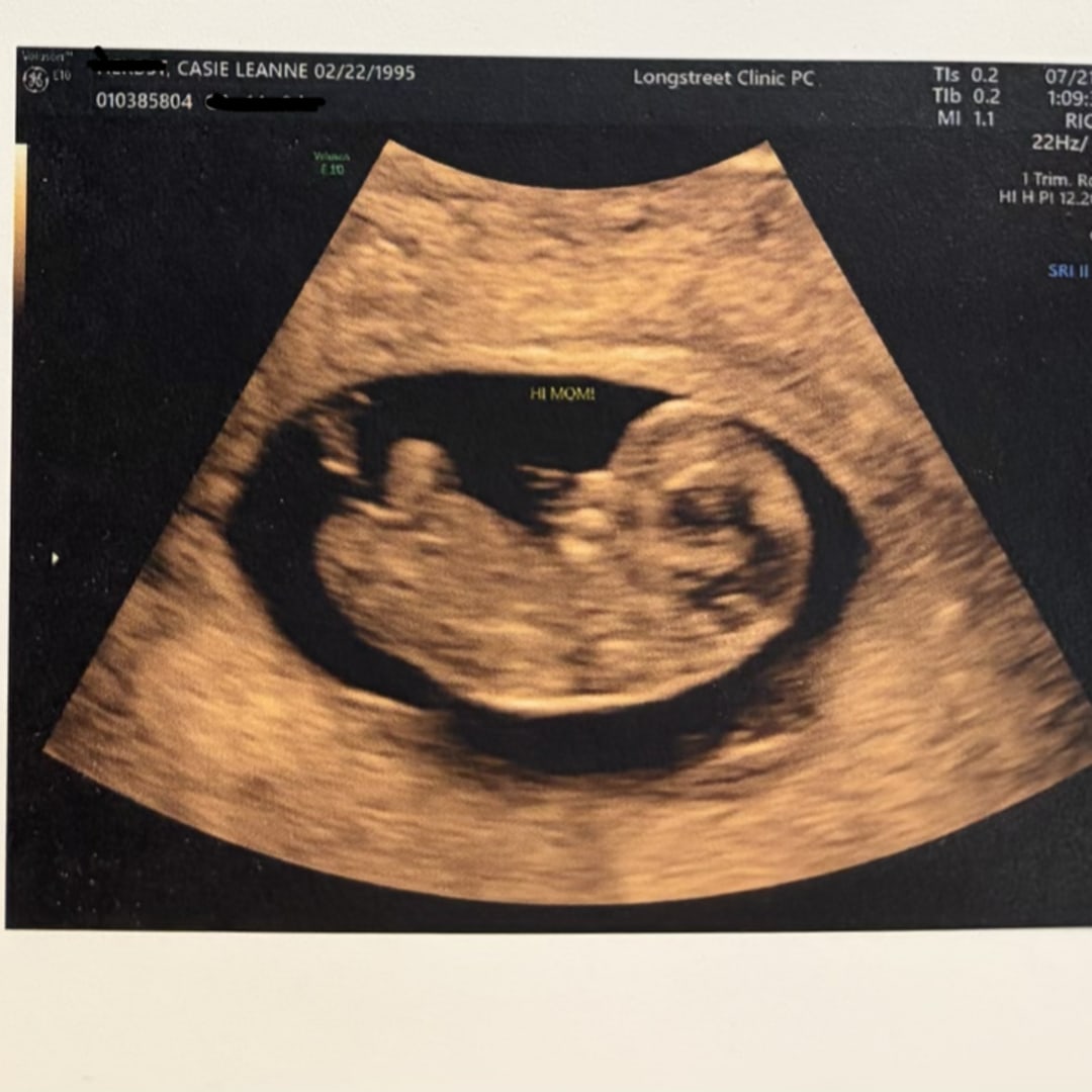 Photo shared by Casie for their Babylist baby registry.