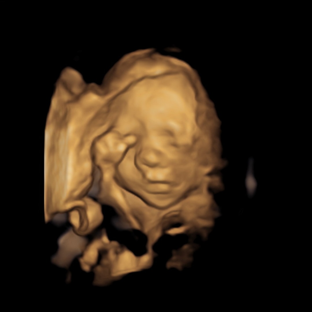 Photo shared by Emma & Nick for their Babylist baby registry.