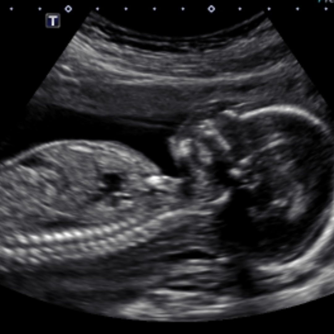 Photo shared by Kielah for their Babylist baby registry.