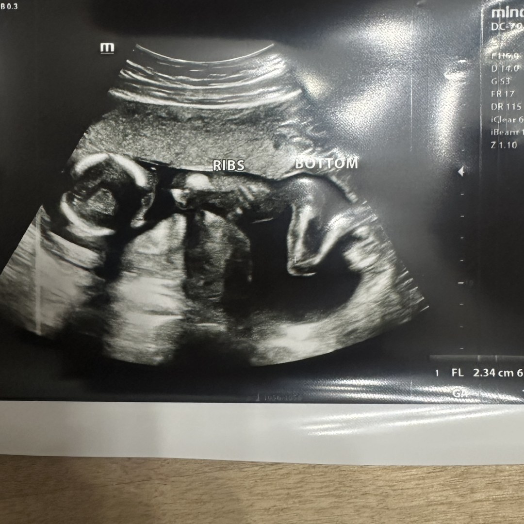 Photo shared by Tree for their Babylist baby registry.