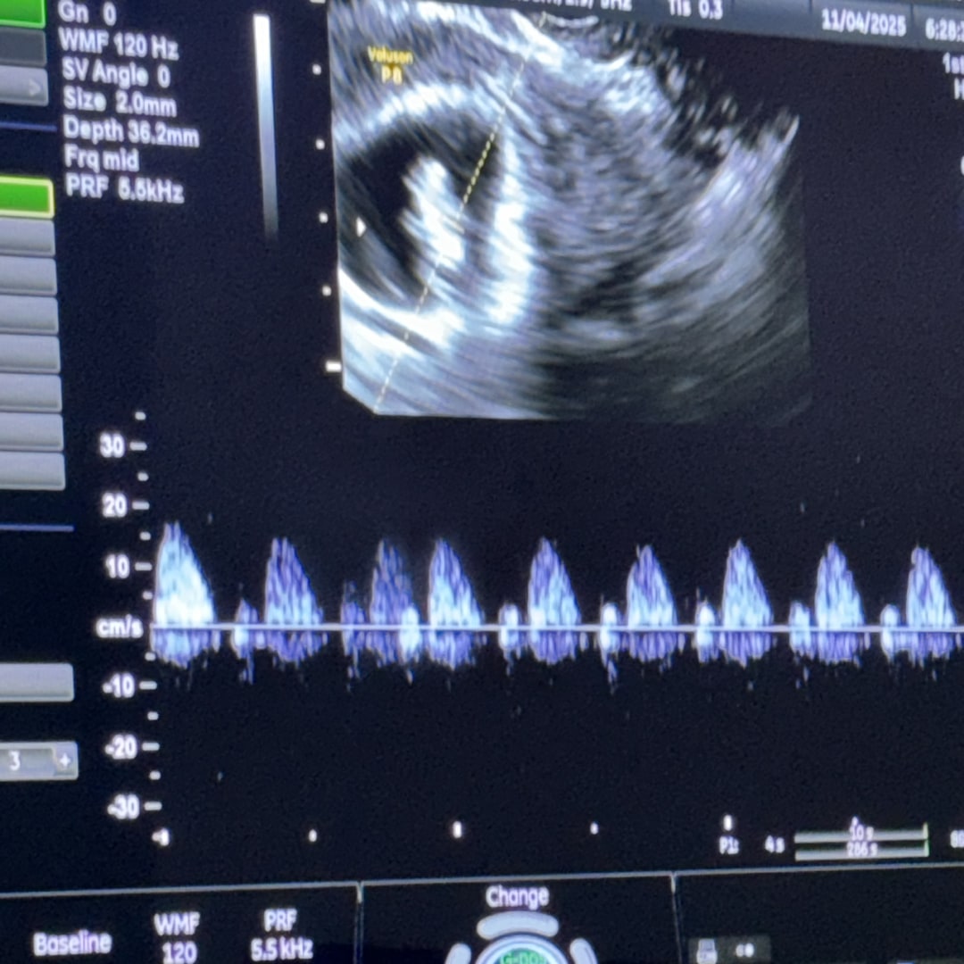 Photo shared by Abranna for their Babylist baby registry.