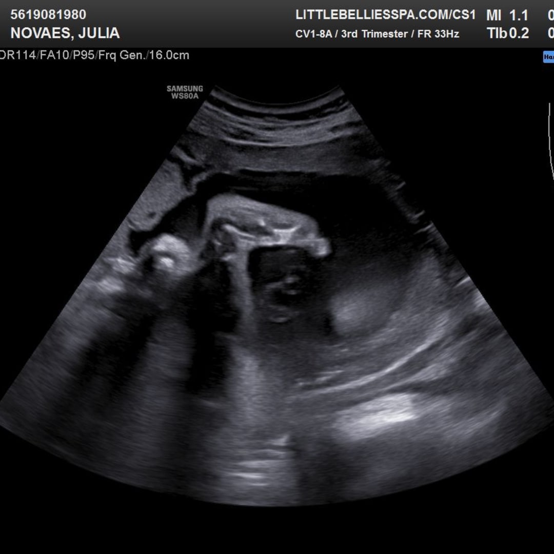 Photo shared by Julia for their Babylist baby registry.