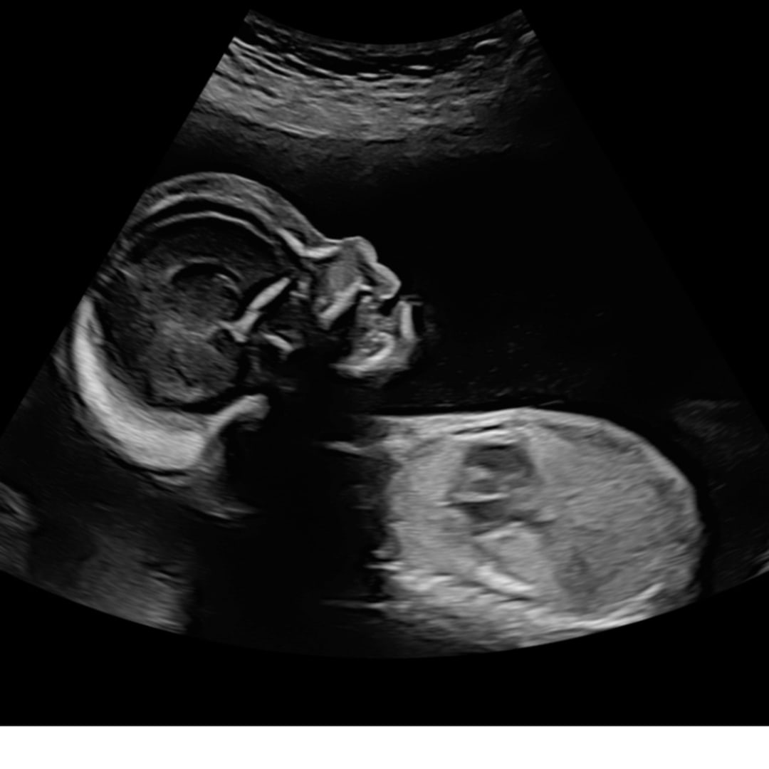 Photo shared by Larisa for their Babylist baby registry.