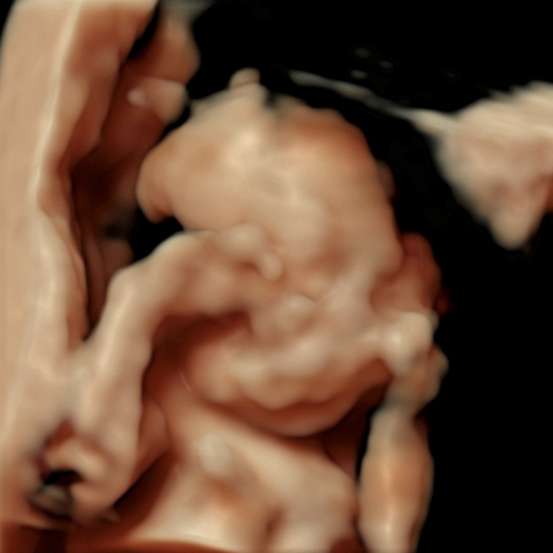Photo shared by Samantha for their Babylist baby registry.