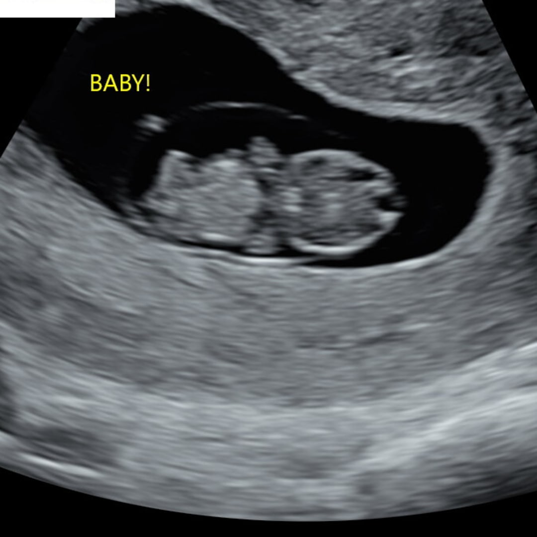 Photo shared by Emily for their Babylist baby registry.