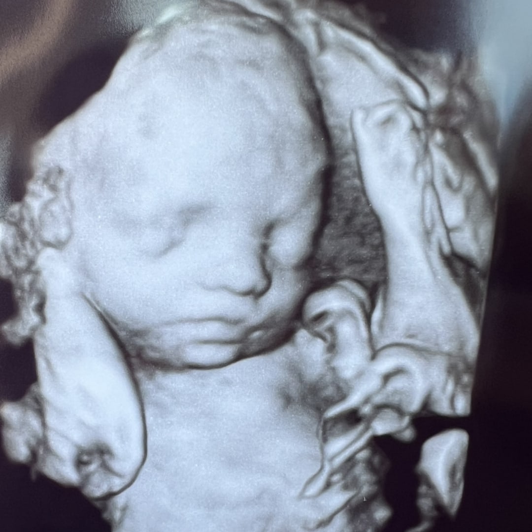 Photo shared by Carissa for their Babylist baby registry.