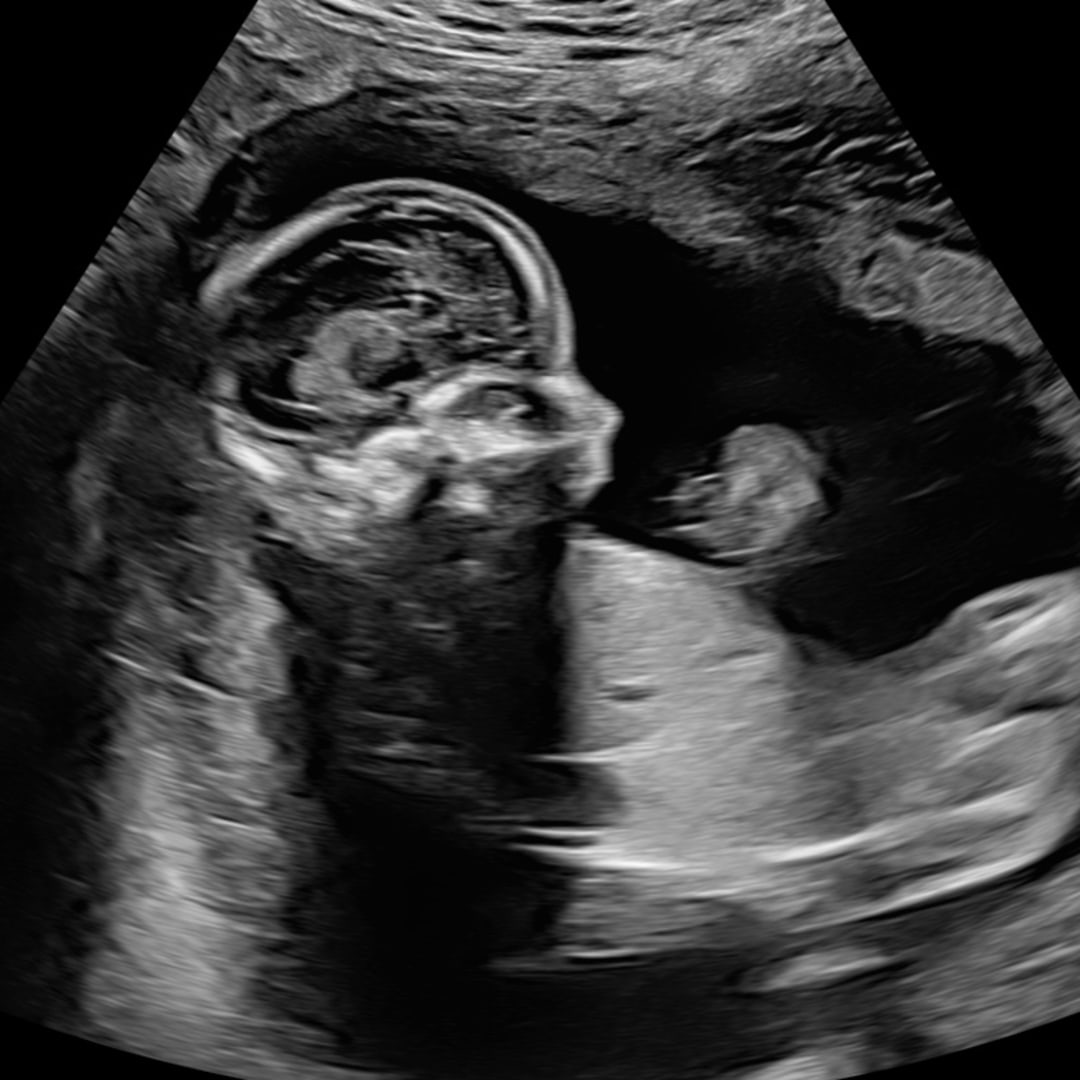 Photo shared by Darcy for their Babylist baby registry.