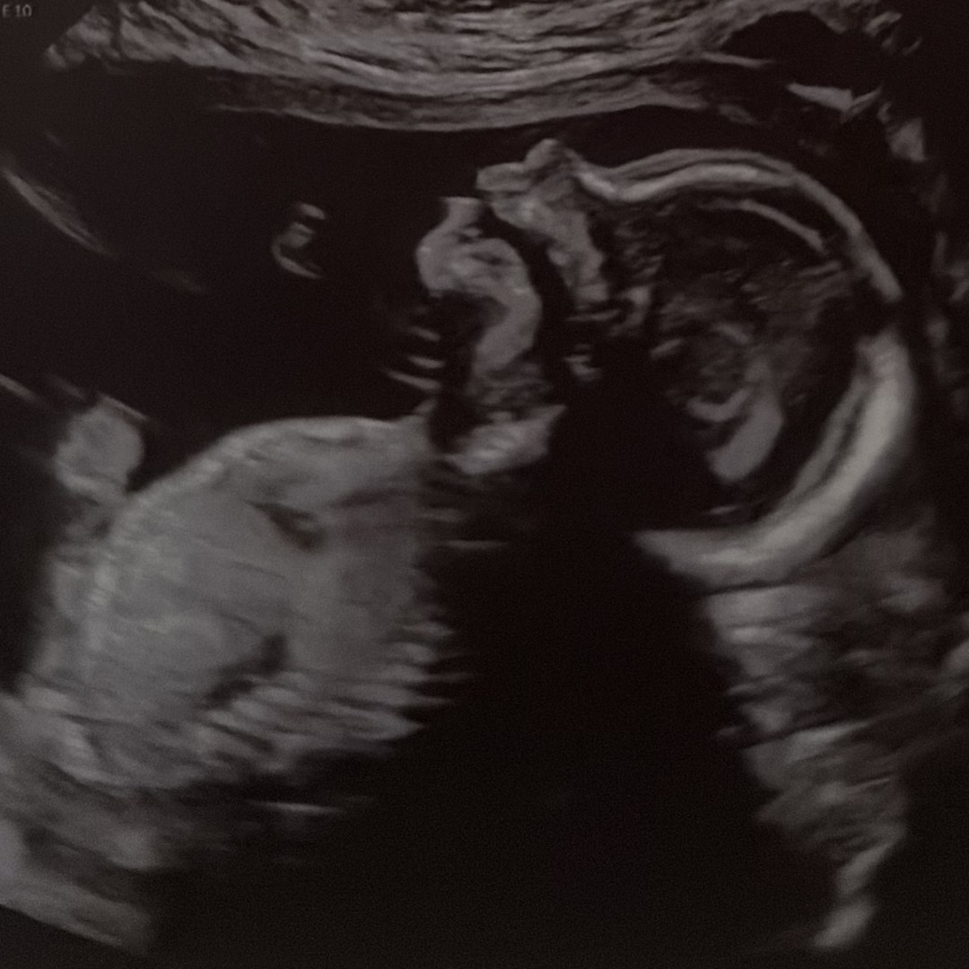 Photo shared by Jovanna for their Babylist baby registry.
