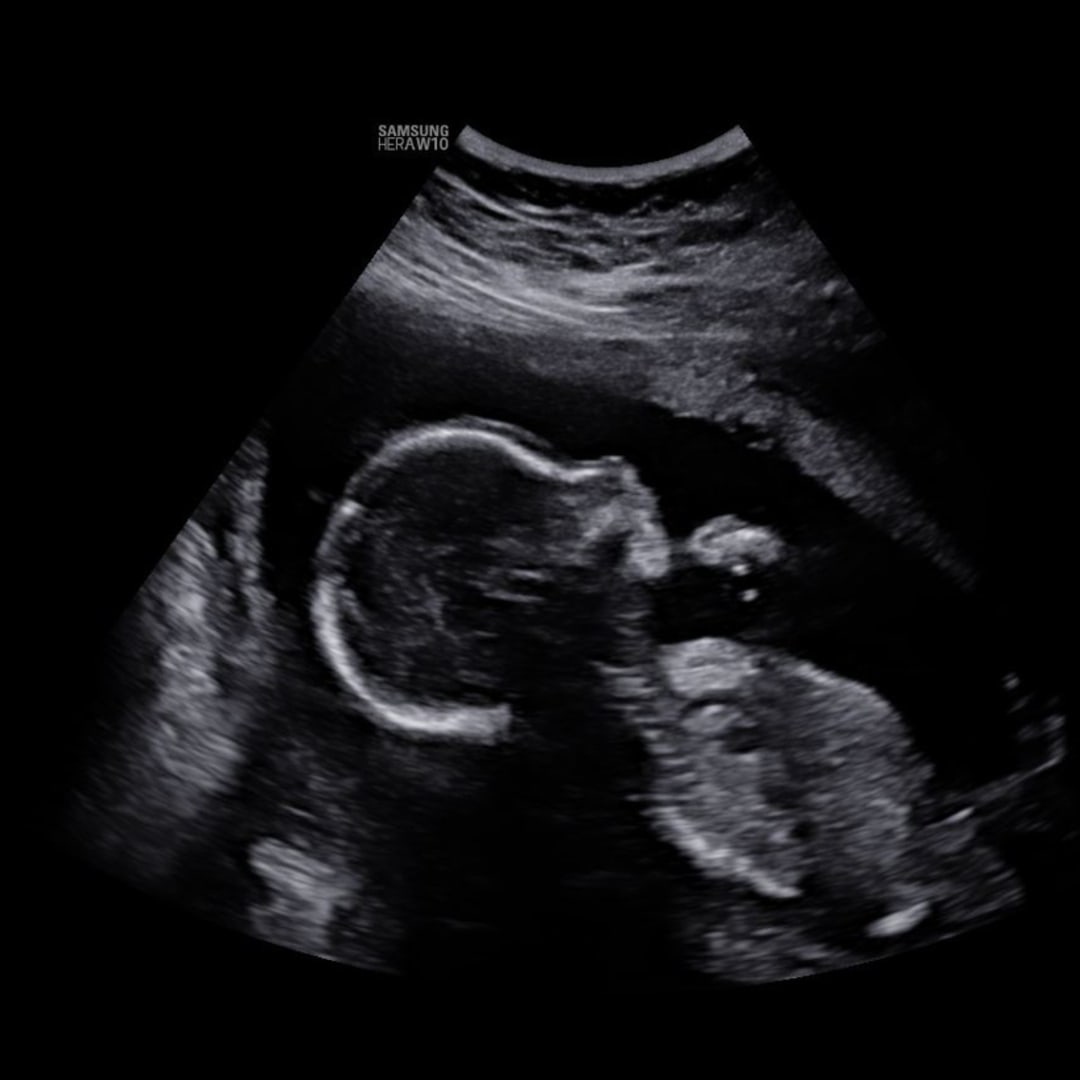 Photo shared by Bri for their Babylist baby registry.