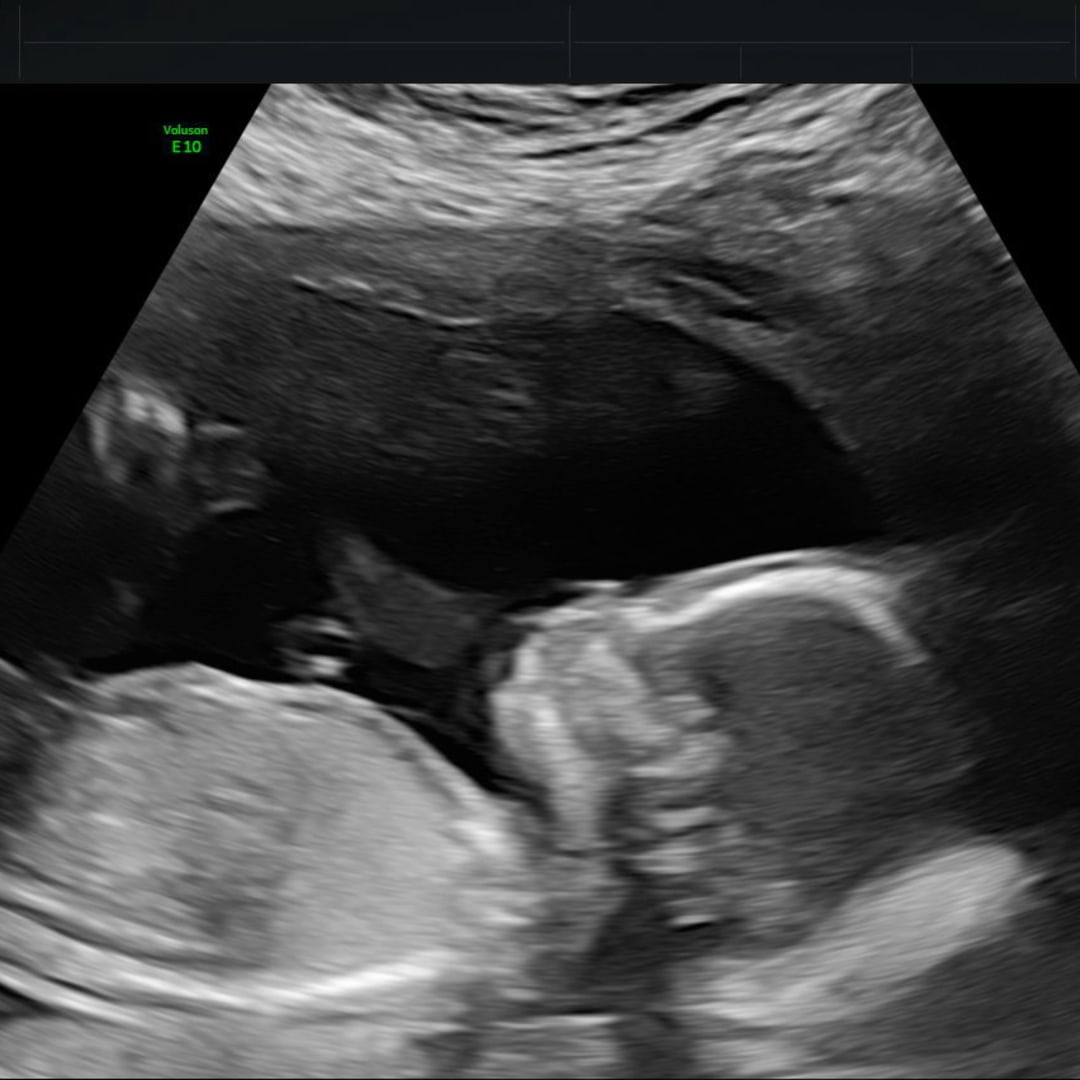 Photo shared by Alexandra for their Babylist baby registry.