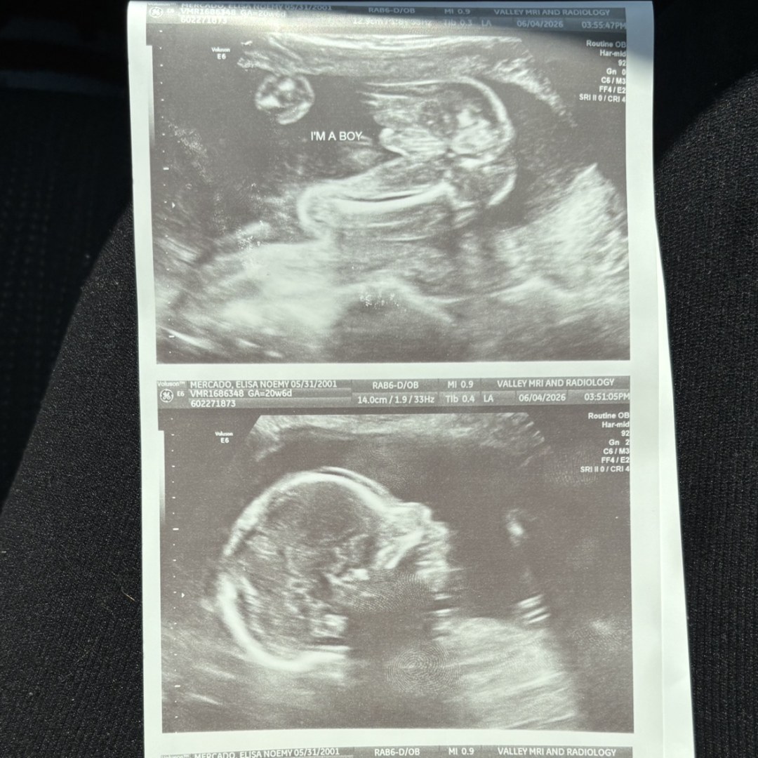 Photo shared by Elisa for their Babylist baby registry.
