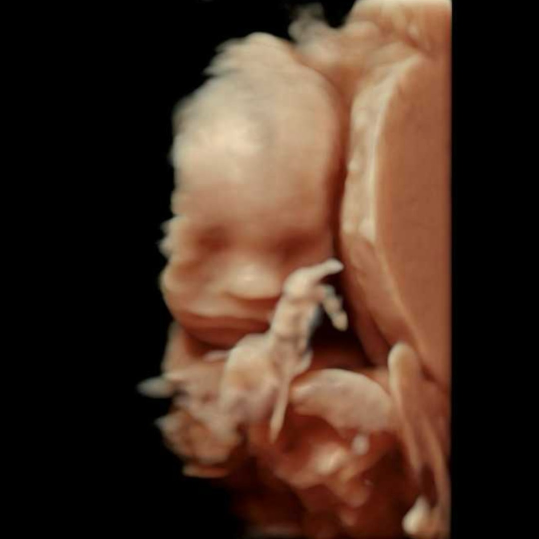 Photo shared by Courtney for their Babylist baby registry.