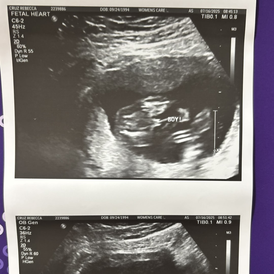 Photo shared by Rebecca for their Babylist baby registry.