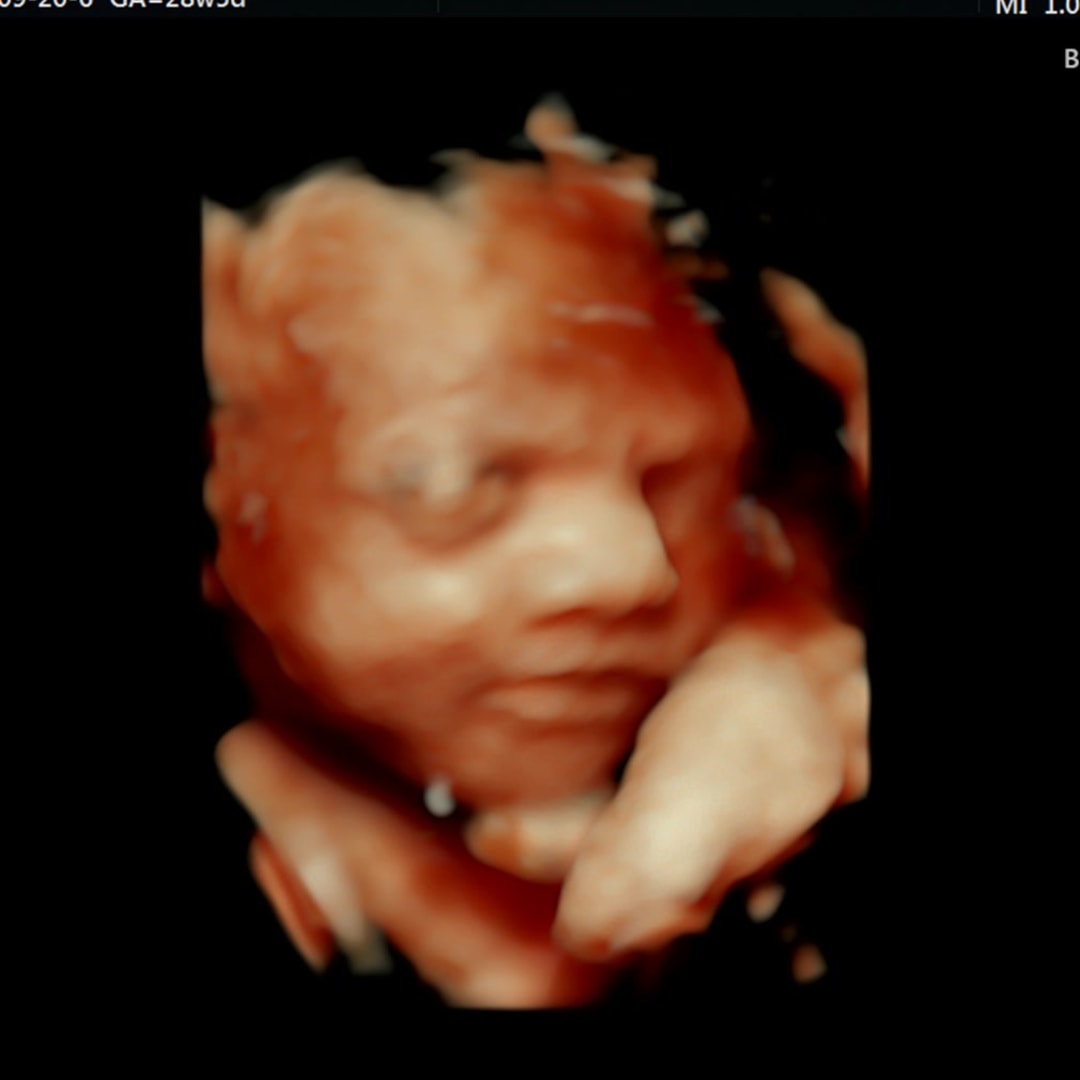 Photo shared by Kaylee for their Babylist baby registry.