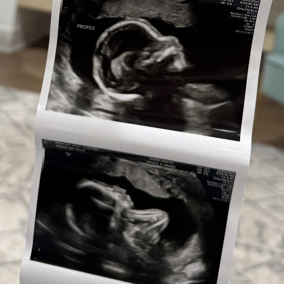 Photo shared by Alexa for their Babylist baby registry.