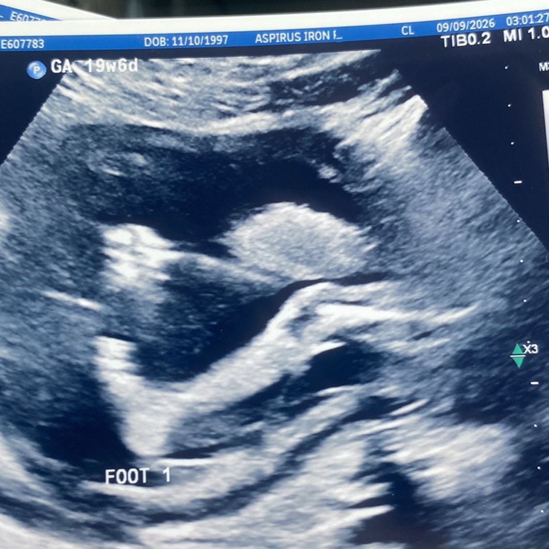 Photo shared by Estella for their Babylist baby registry.