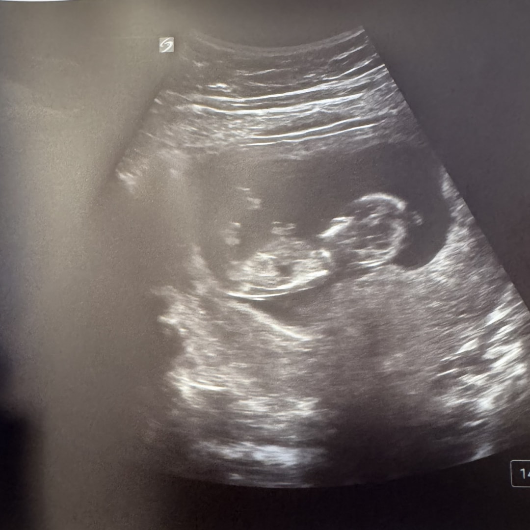 Photo shared by Anna for their Babylist baby registry.