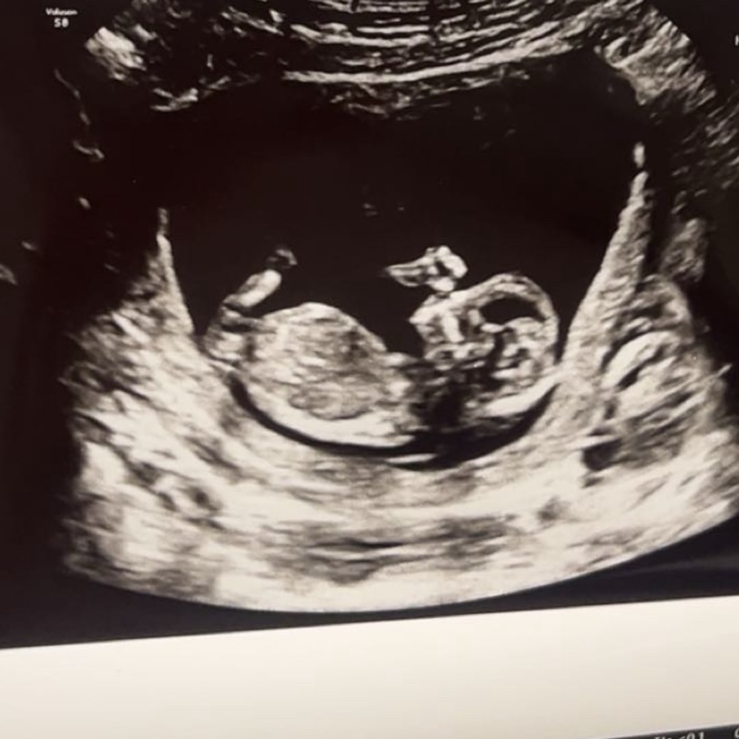 Photo shared by Elli for their Babylist baby registry.