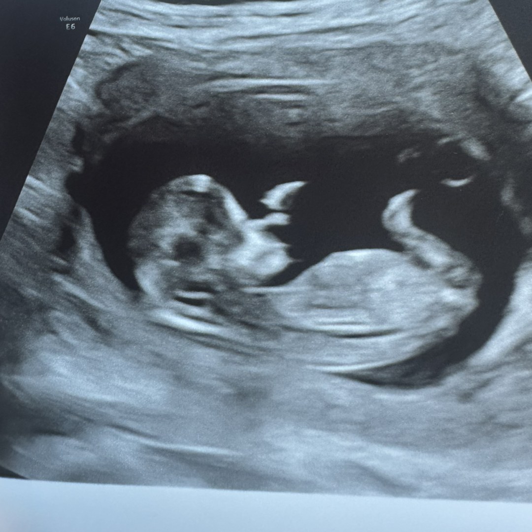 Photo shared by Cinthya for their Babylist baby registry.