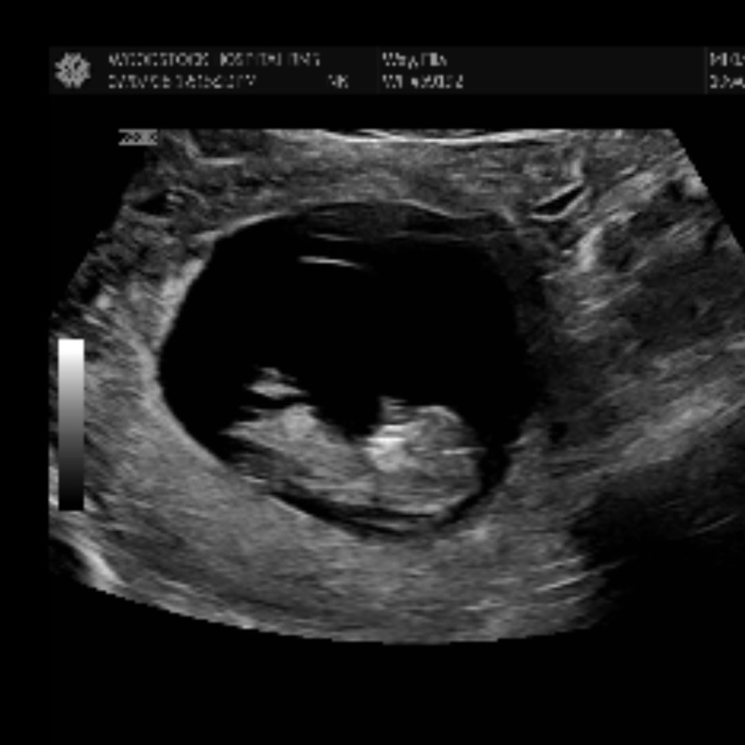 Photo shared by Ella for their Babylist baby registry.