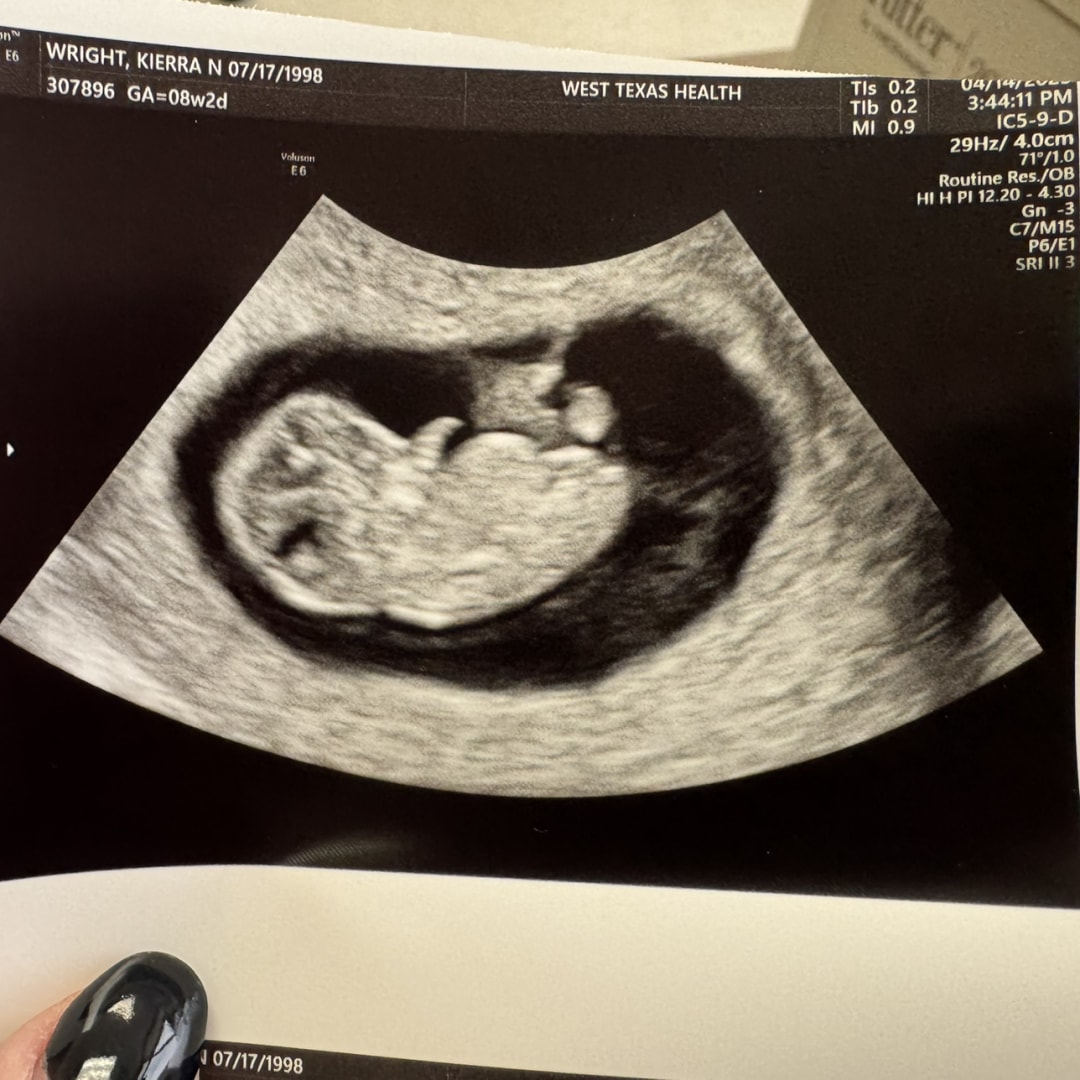 Photo shared by Kierra for their Babylist baby registry.