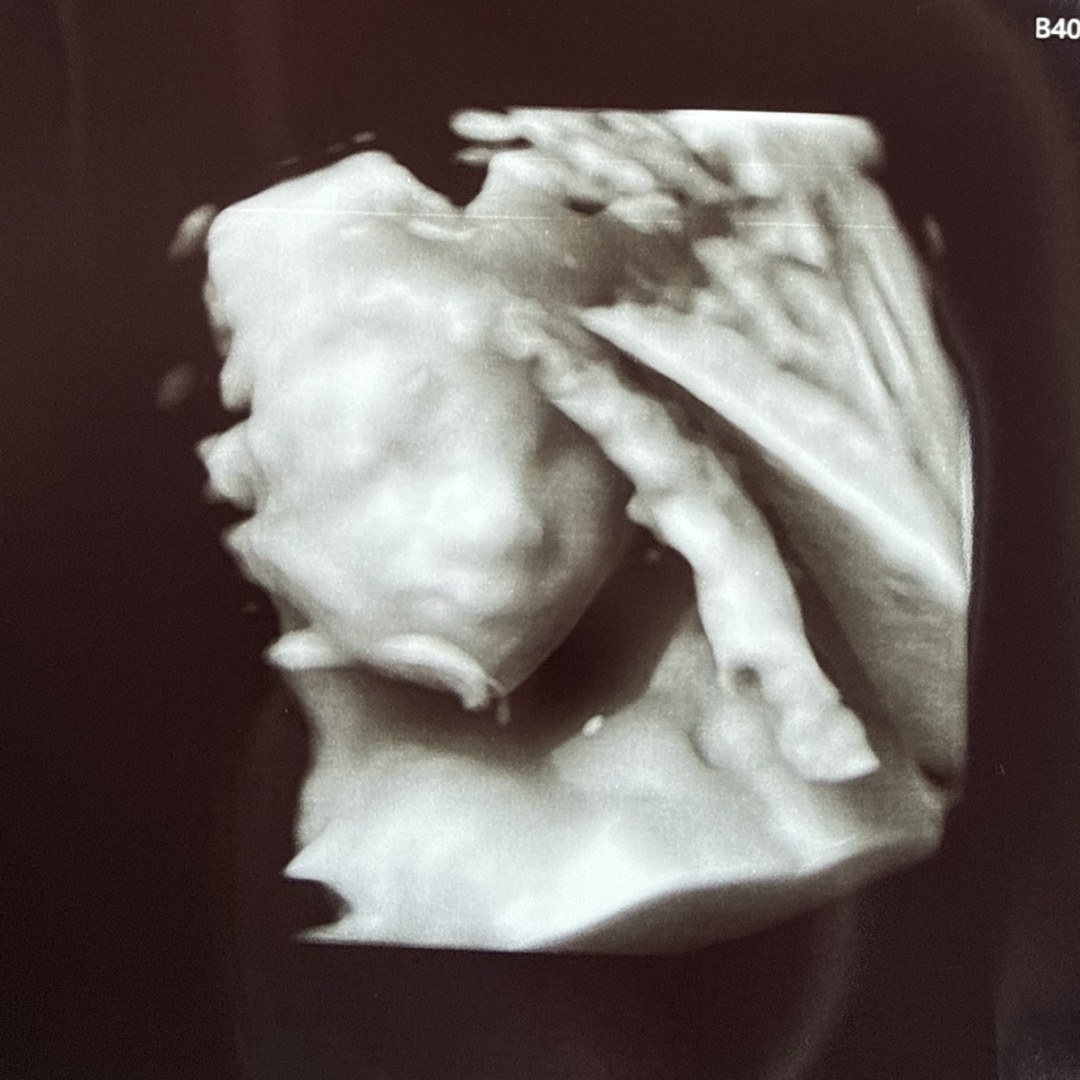 Photo shared by Abigail for their Babylist baby registry.