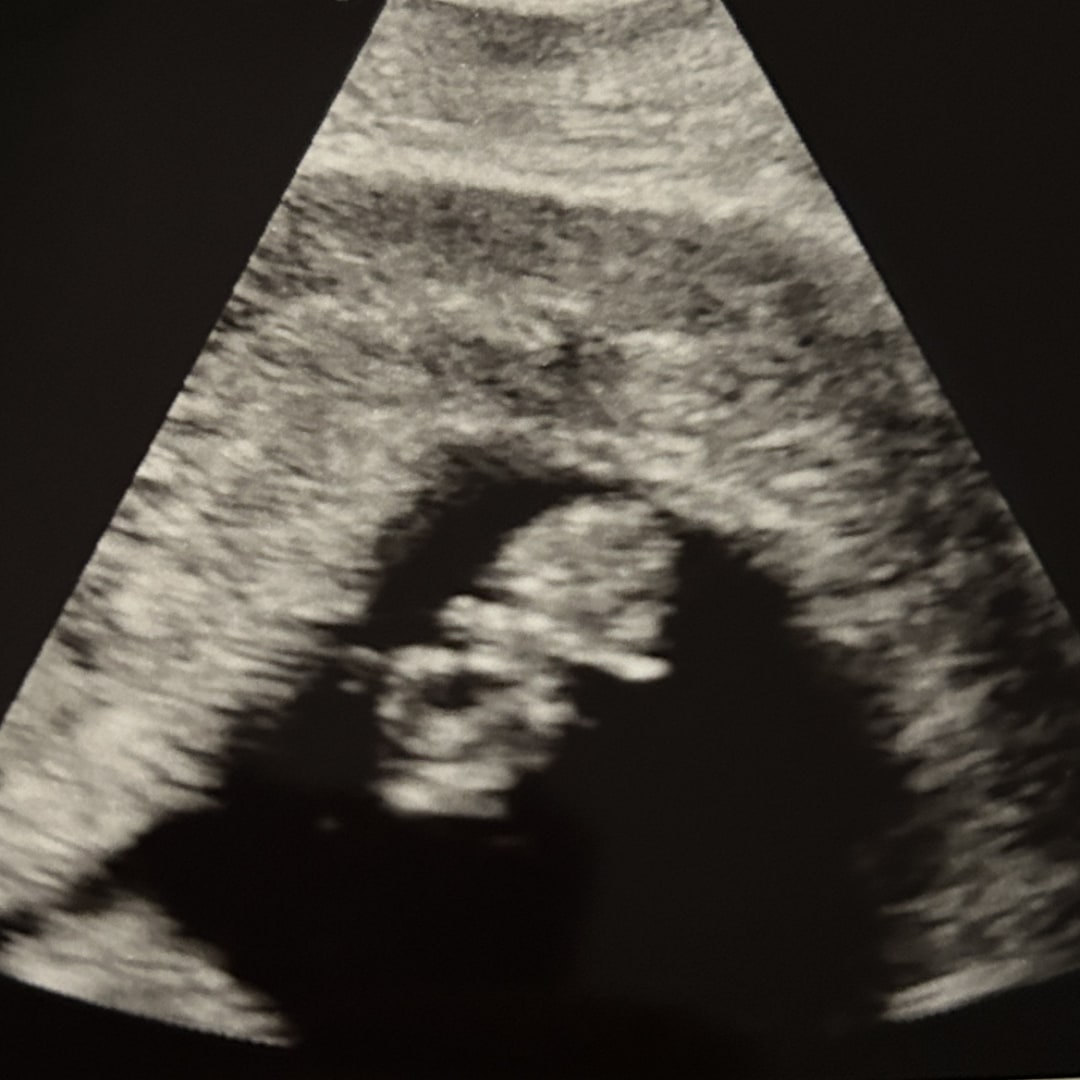 Photo shared by Alison for their Babylist baby registry.
