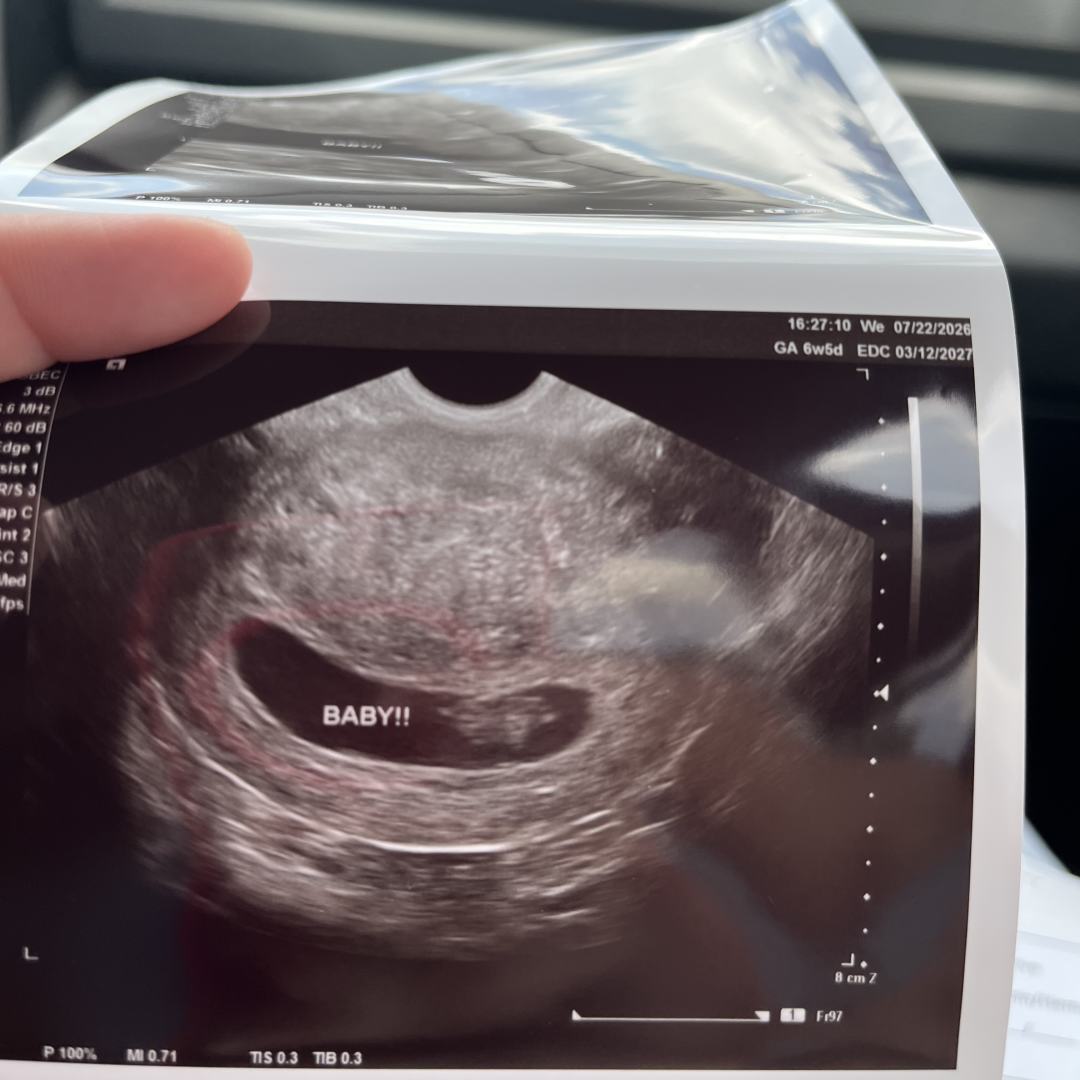 Photo shared by Elisabeth for their Babylist baby registry.