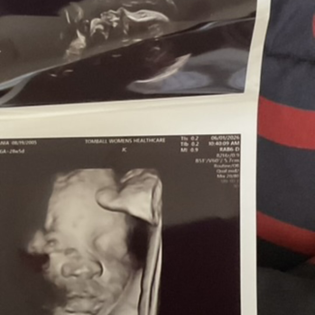 Photo shared by Jania for their Babylist baby registry.