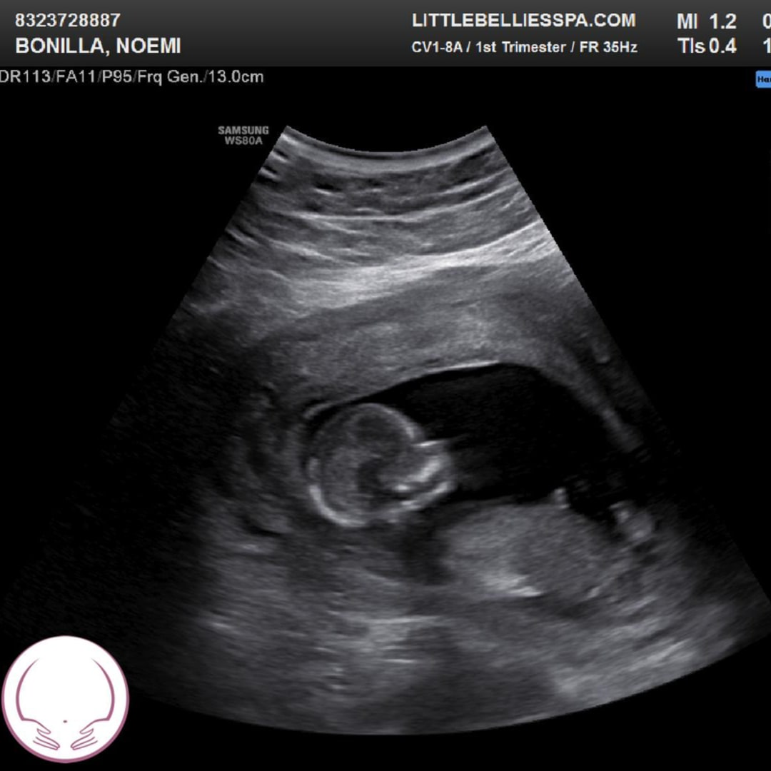 Photo shared by Noemi for their Babylist baby registry.