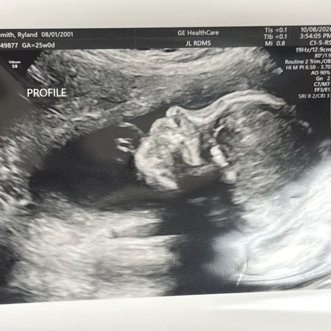 Photo shared by Rylie for their Babylist baby registry.