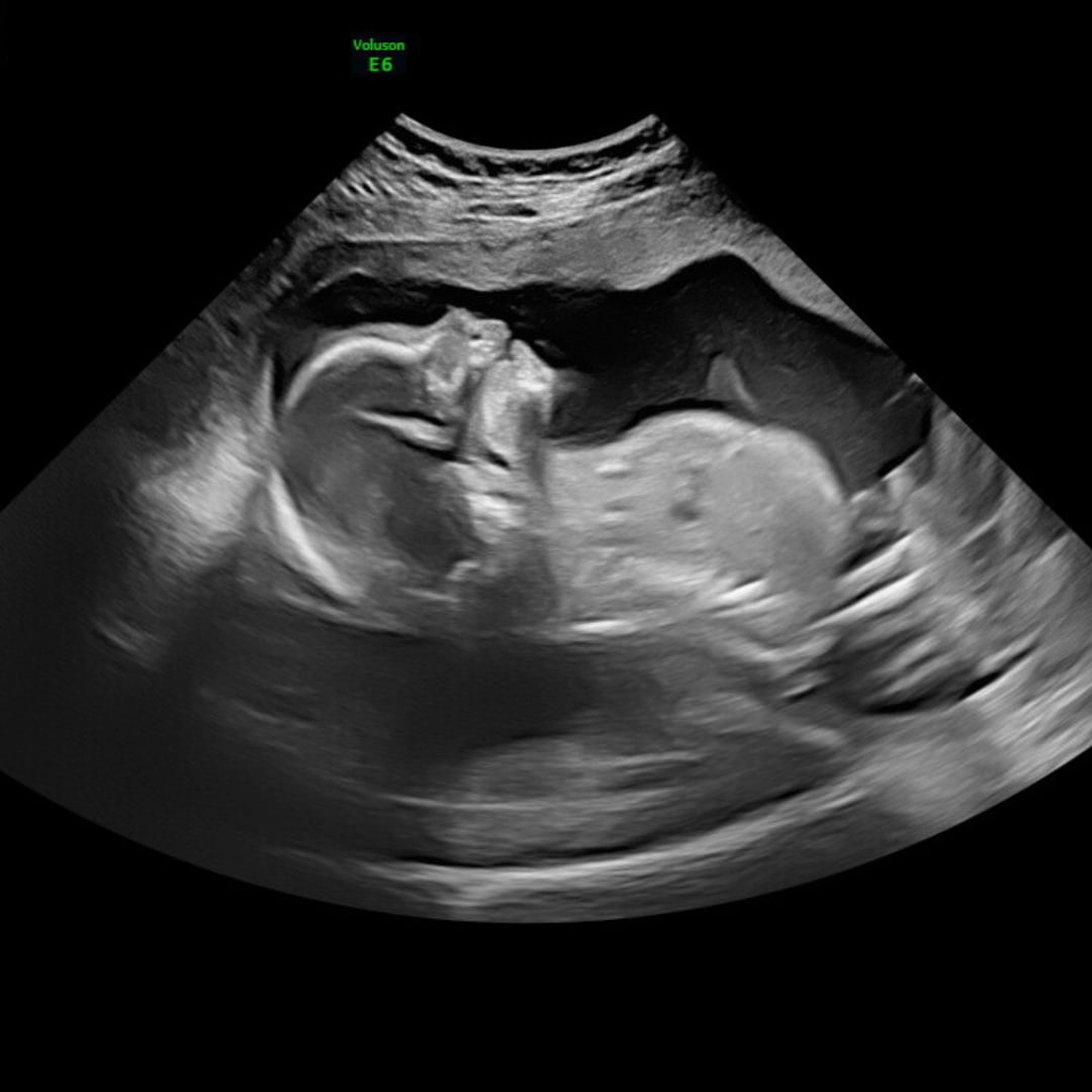 Photo shared by Brittany for their Babylist baby registry.