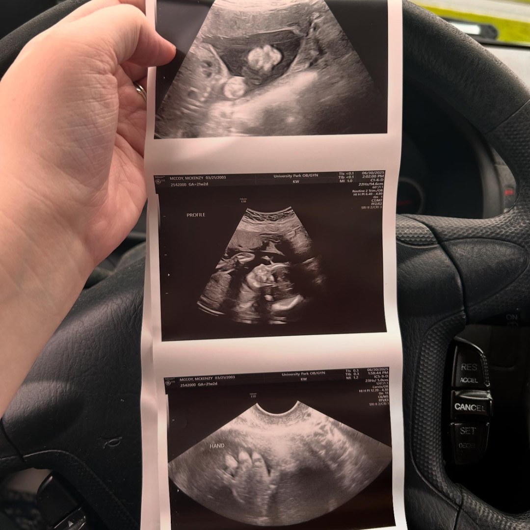 Photo shared by Kenzy for their Babylist baby registry.
