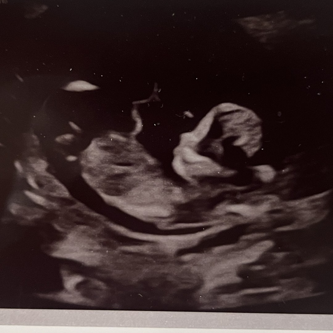 Photo shared by Alicia for their Babylist baby registry.