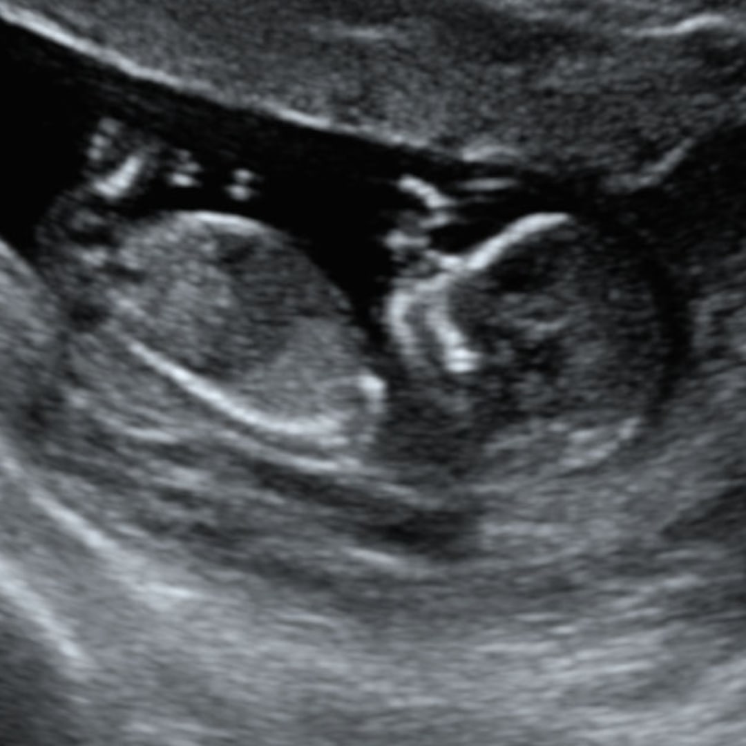 Photo shared by Katelynn for their Babylist baby registry.