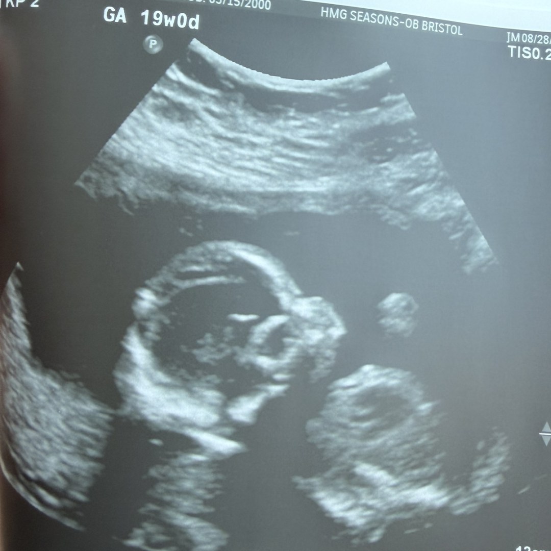 Photo shared by Desiree for their Babylist baby registry.