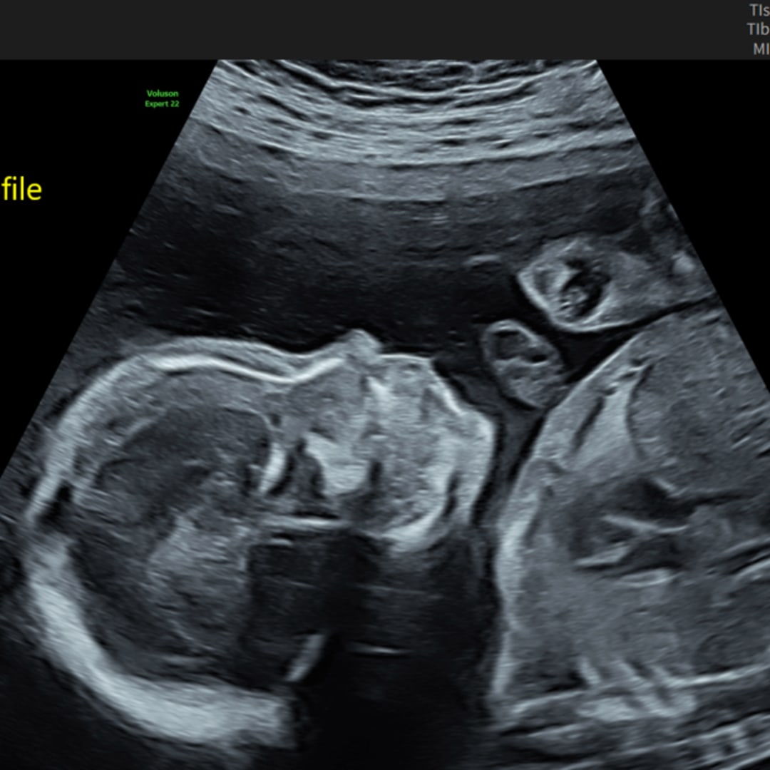 Photo shared by Caitlin for their Babylist baby registry.