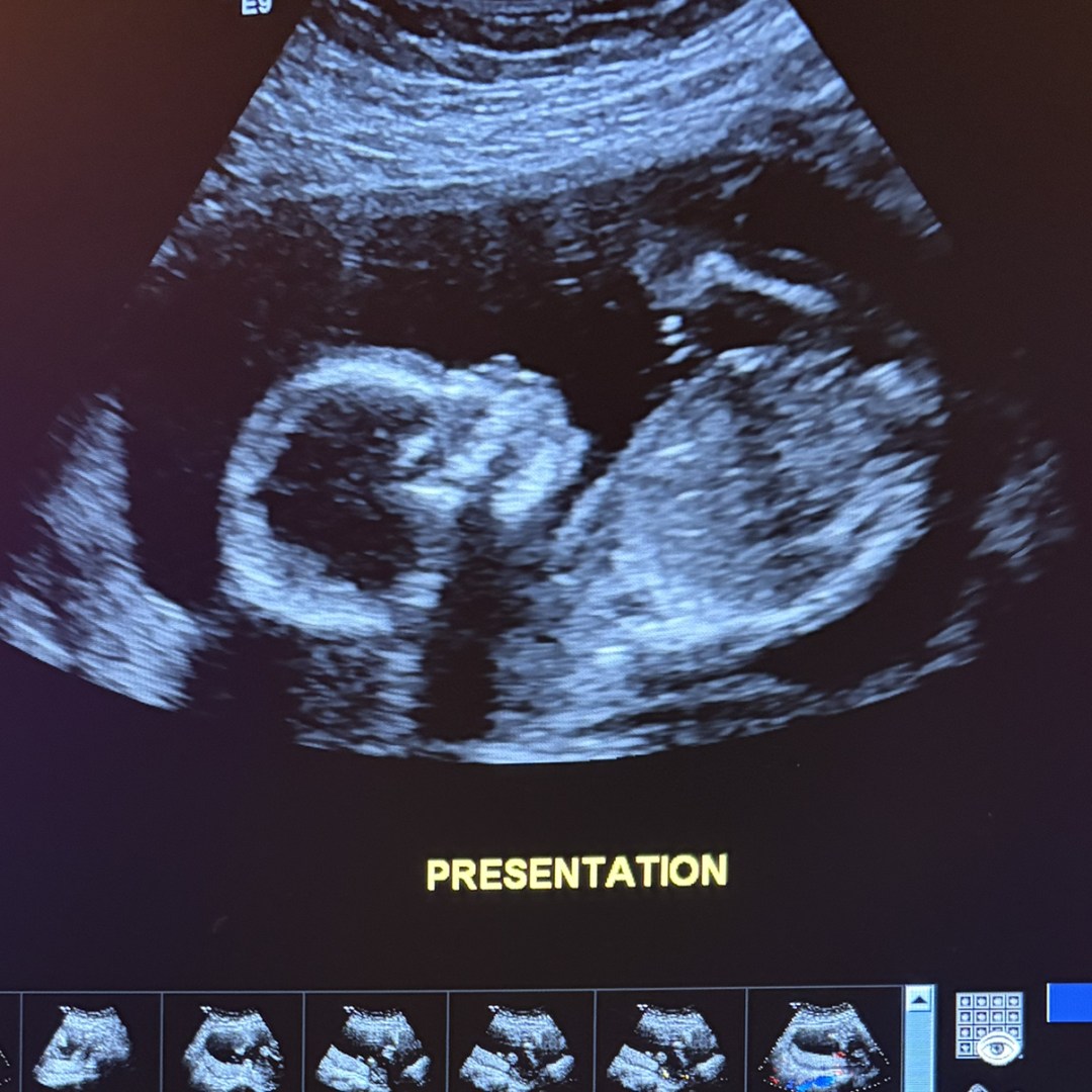 Photo shared by Araceli for their Babylist baby registry.