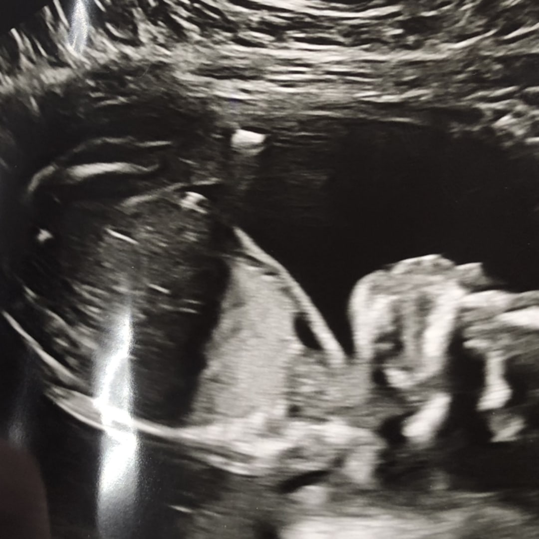 Photo shared by Misty for their Babylist baby registry.