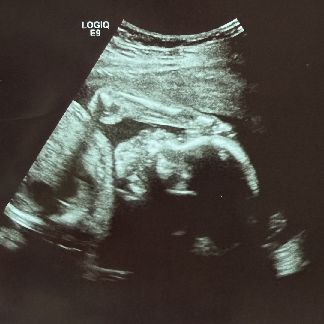 Photo shared by Dakota for their Babylist baby registry.