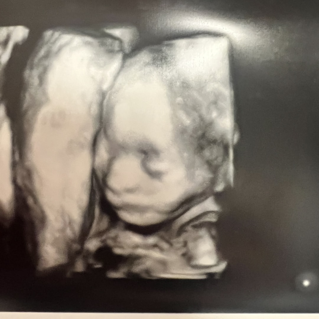 Photo shared by Cassie for their Babylist baby registry.