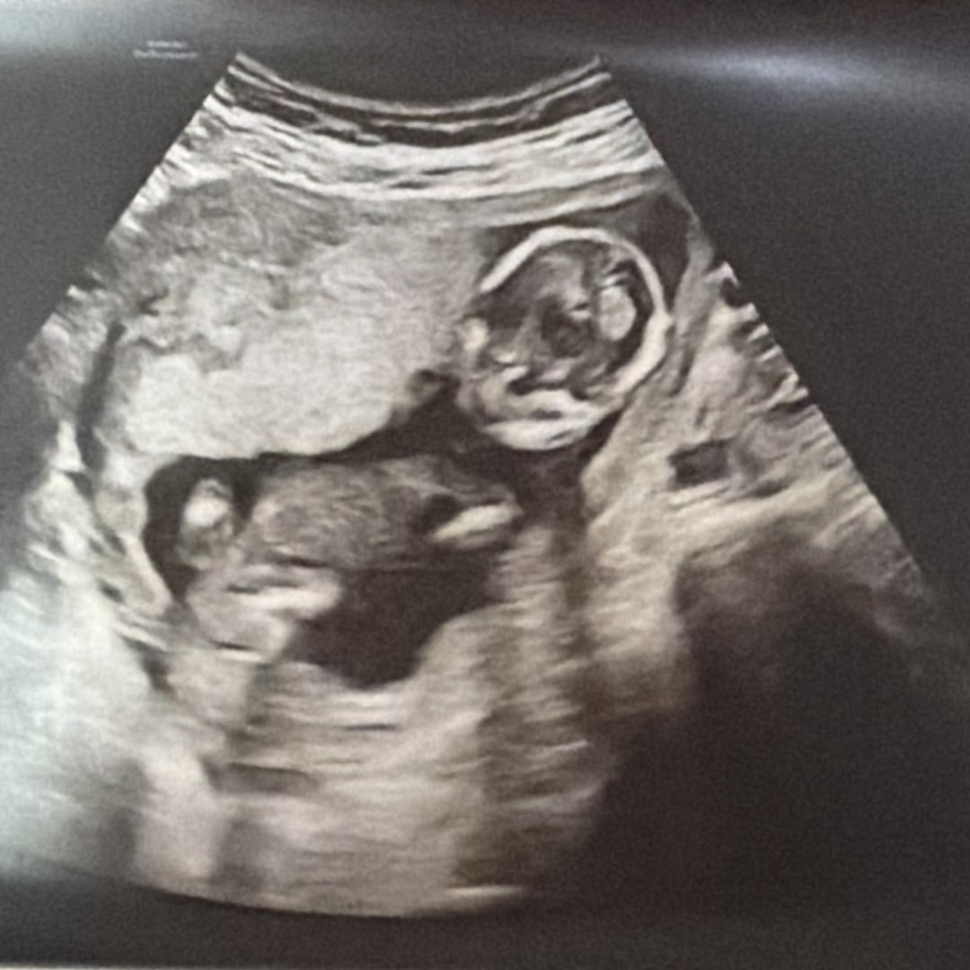 Photo shared by Emma for their Babylist baby registry.