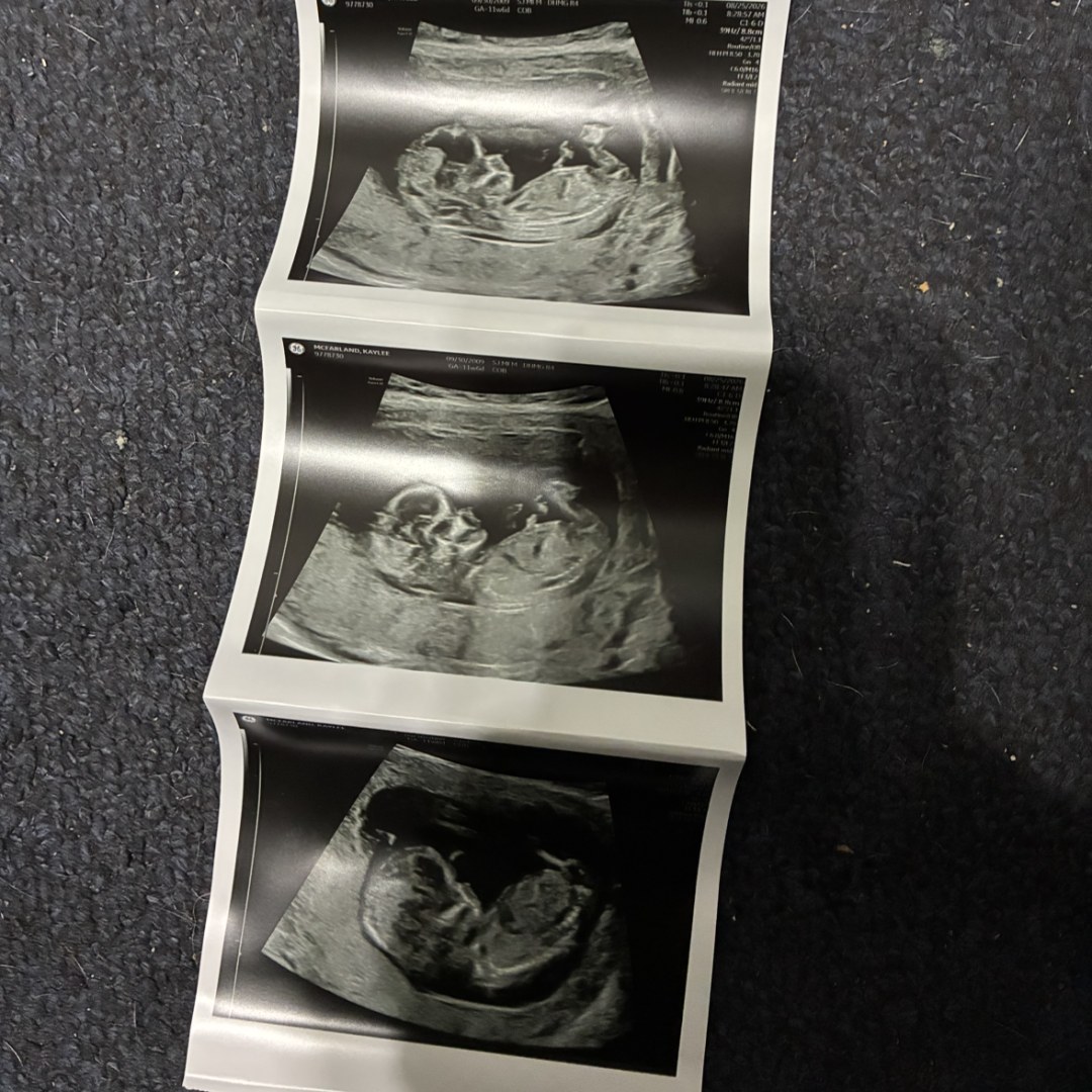 Photo shared by Kaylee for their Babylist baby registry.