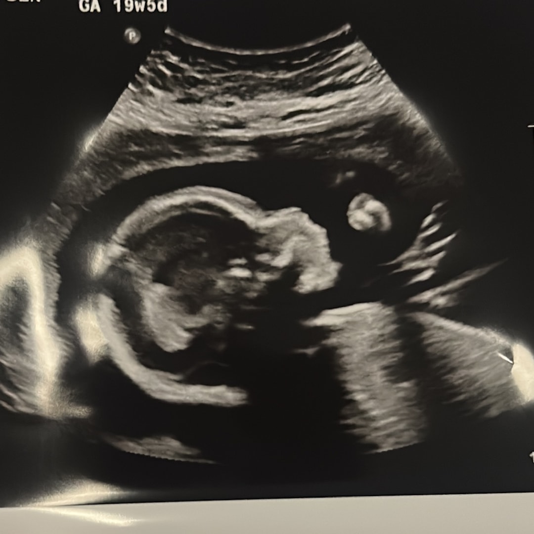 Photo shared by Meghan for their Babylist baby registry.