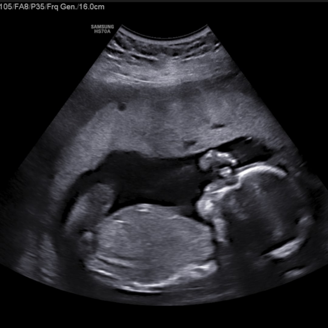 Photo shared by Brittany for their Babylist baby registry.