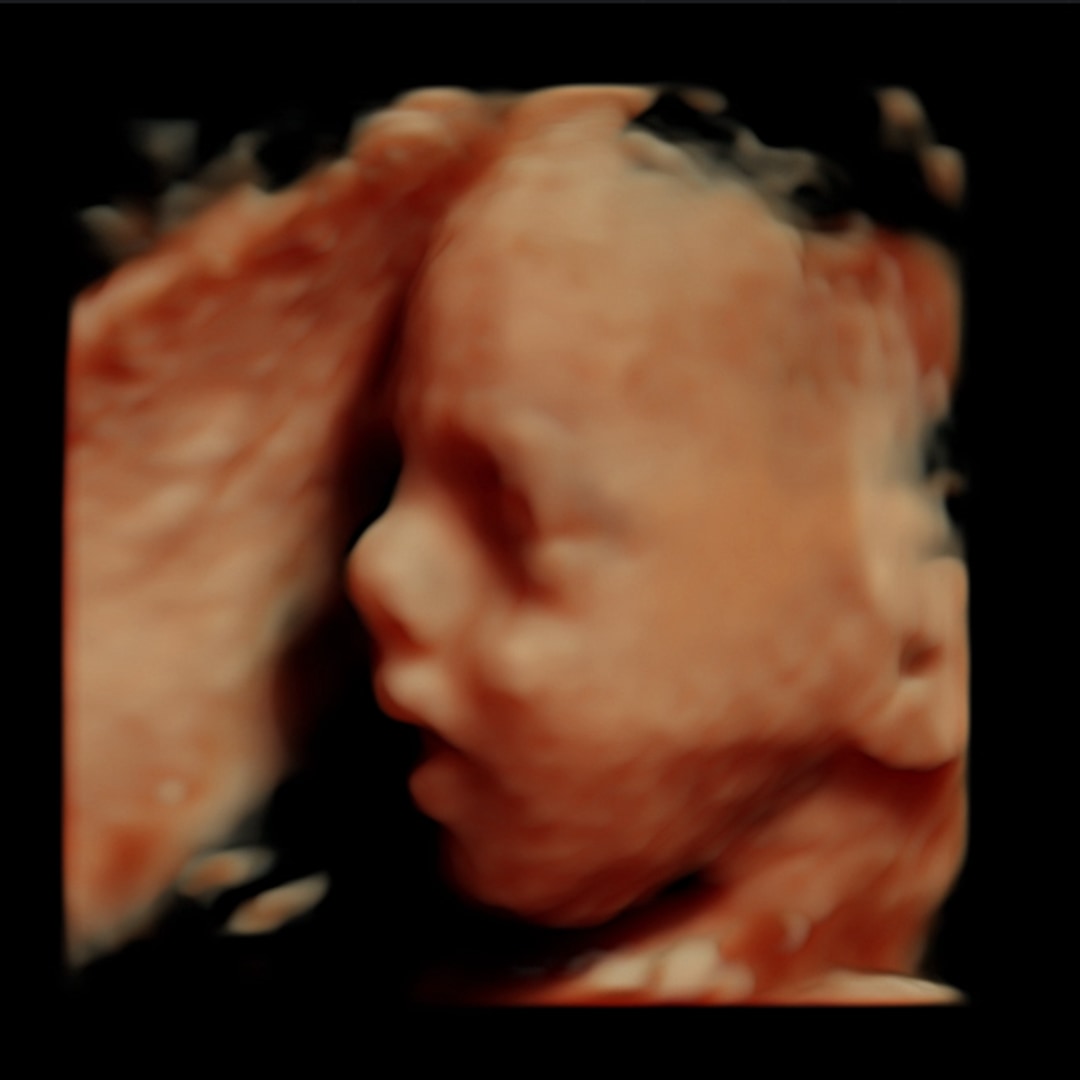 Photo shared by Lindsey for their Babylist baby registry.