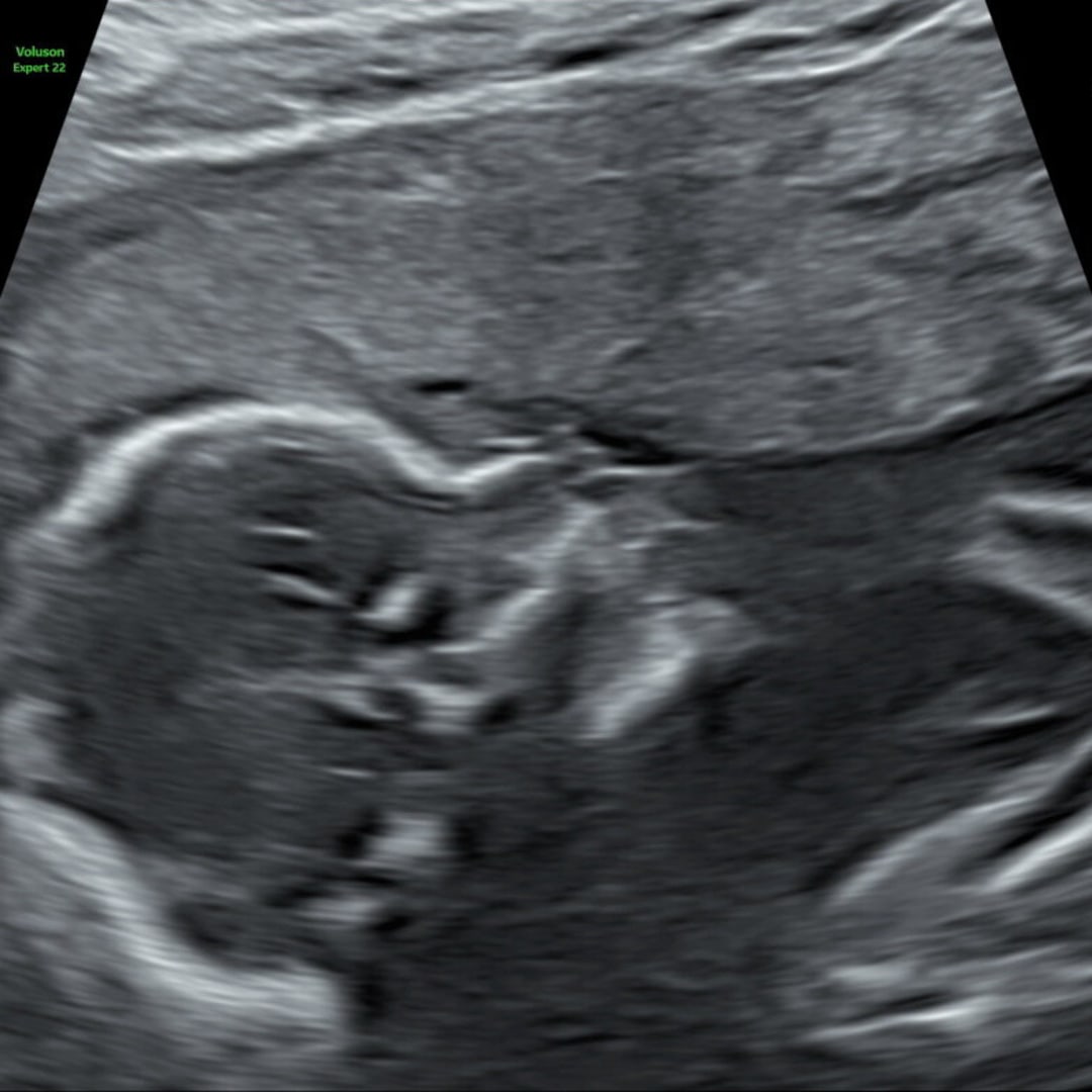 Photo shared by Nicole for their Babylist baby registry.