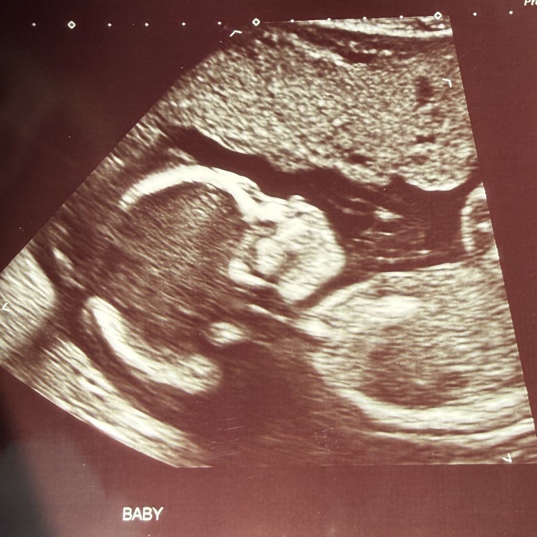 Photo shared by Luisa for their Babylist baby registry.