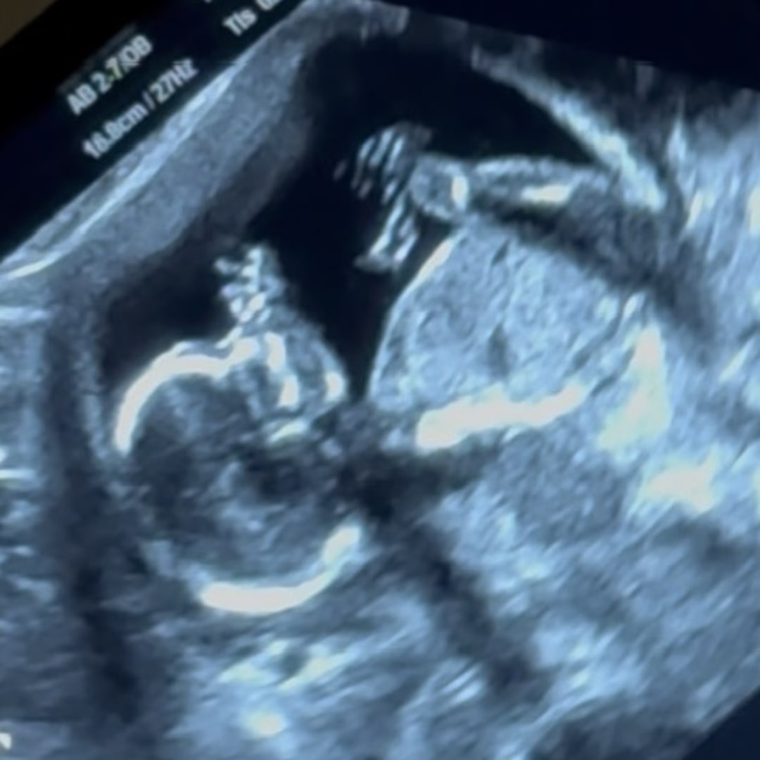 Photo shared by Carlee for their Babylist baby registry.