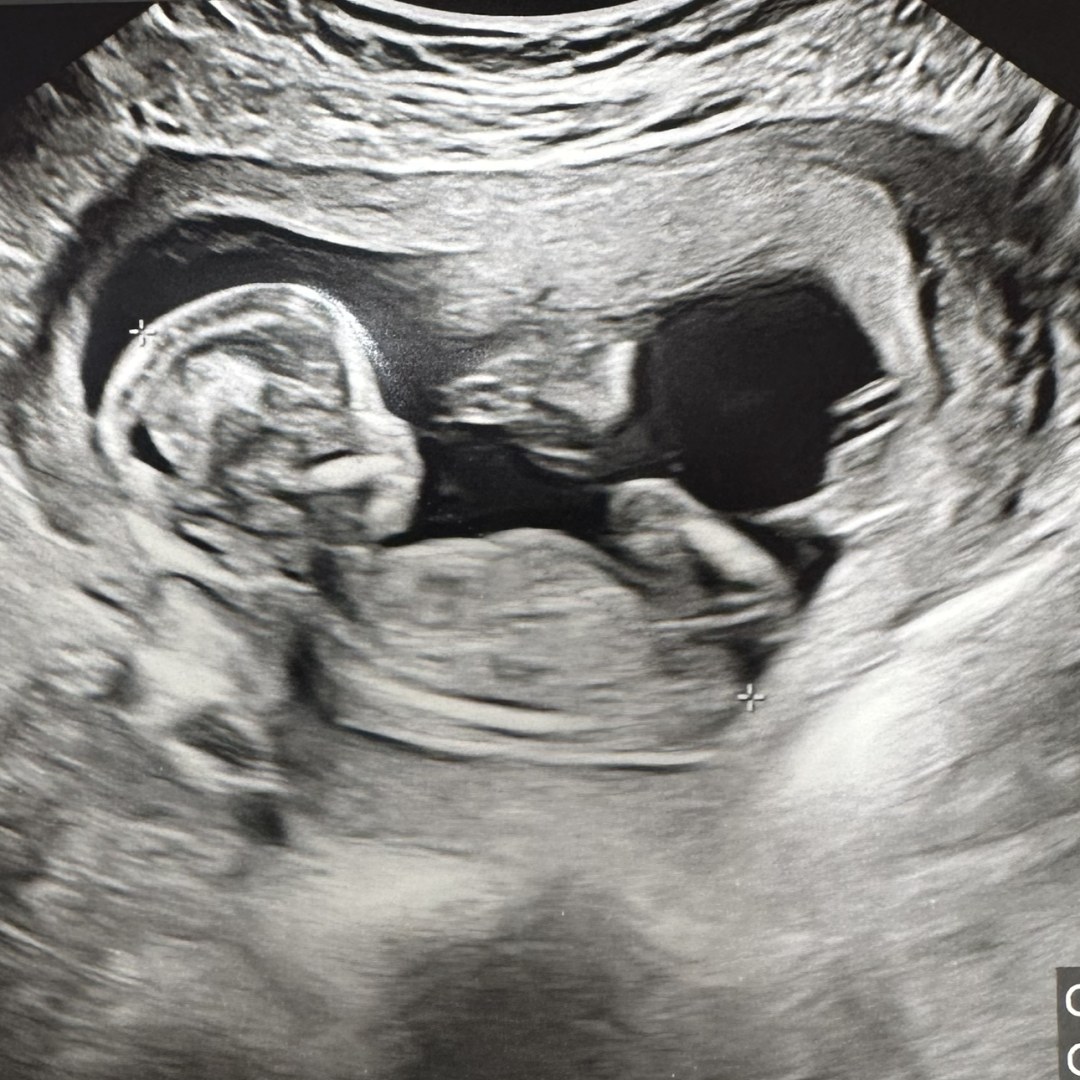 Photo shared by Chelsea for their Babylist baby registry.